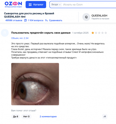 Queenlash отзывы: стоит ли рисковать ради длинных ресниц