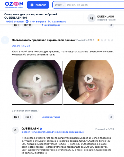 Queenlash отзывы: Почему не стоит рисковать здоровьем ради идеальных ресниц?