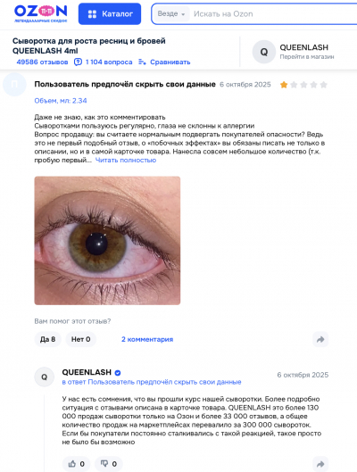 Queenlash: цена идеальных ресниц — здоровье глаз?